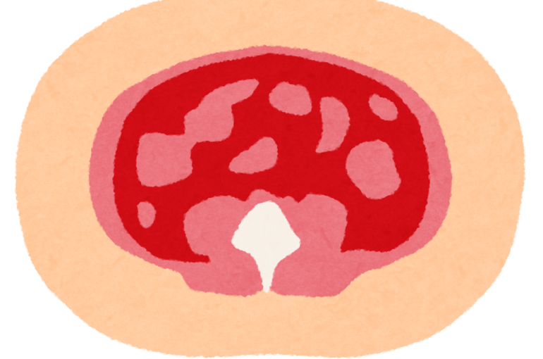 body_danmen_shibou_hika